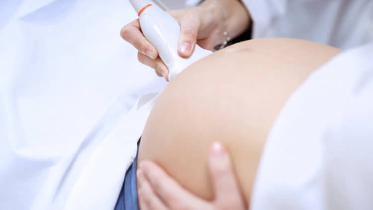 nőgyógyász, ultrahang vizsgálat, ultrahangos vizsgálatok